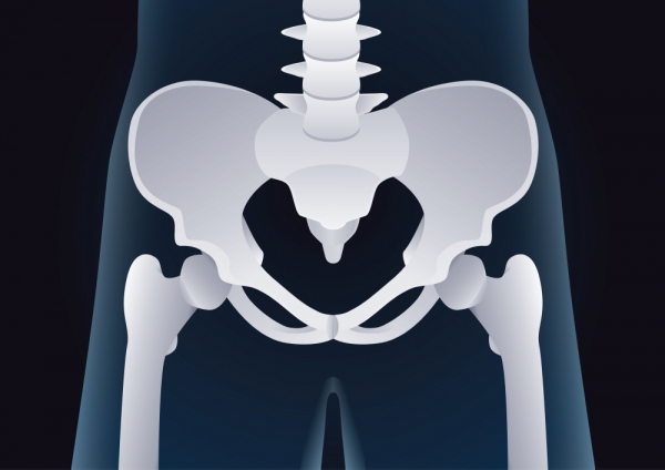 골반뼈 이미지