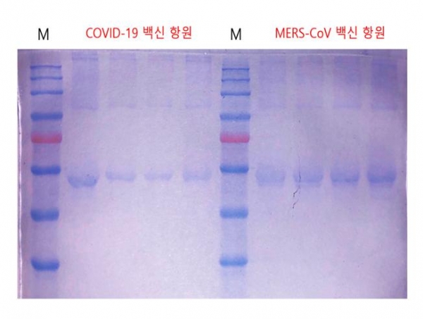 코로나바이러스-19 백신 항원 확인