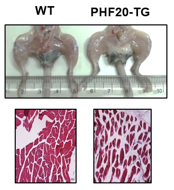 그림 1-PHF20 과발현 마우스의 근육분화 저해와 지방침착현상