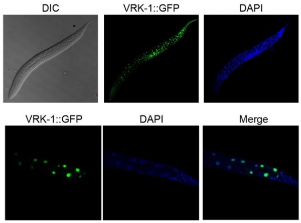 예쁜꼬마선충서 나타나는 VRK-1 단백질 발현패턴(위)과 예쁜꼬마선충 핵 내부에 존재하는 VRK-1(아래, 형광색)