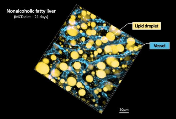 지방간의 3차원 생체현미경 영상 결과
