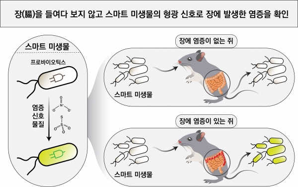 장 내 염증을 진단하는 스마트 미생물 개념도.
