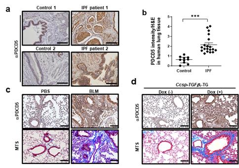 특발성 폐섬유화 환자 및 폐섬유화 유도 생쥐모델에서 PDCD5의 증가