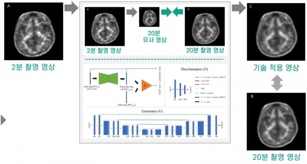 뇌 단층 촬영 이미지 복원 솔루션