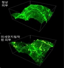 비선형광학현미경으로 이미징한 인체 피부 3차원 표면영상