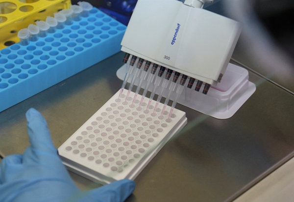 연구팀이 엑토-5’-뉴클레오티다제 억제물질의 효능을 확인하기 위한 세포배양실험을 수행하고 있다.