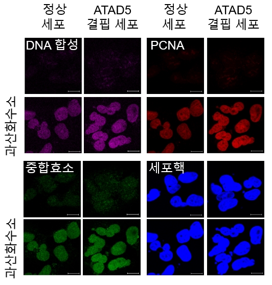 활성산소에 의한 복구 DNA 합성 비교