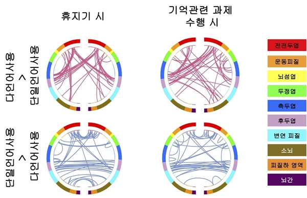 다언어 사용 아동과 단일언어 사용 아동의 뇌 전체 연결망 차이를 나타내는 이미지