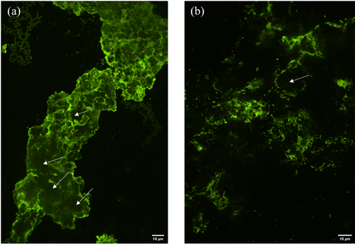공초점 현미경을 통해 미생물과 미세플라스틱(녹색)의 상호작용 관찰 모습 / KBSI 제공