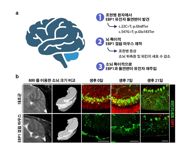 EBP1 결핍 마우스를 이용한 조현병 연구의 개념도