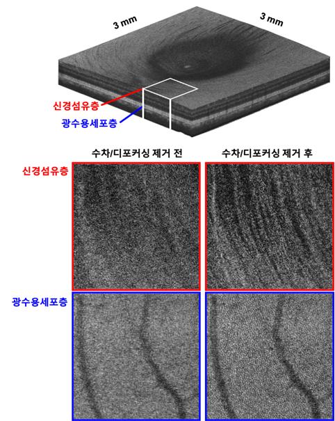 넓은 영역에 걸친 3차원 전부분 세포수준 고해상도 망막 이미징