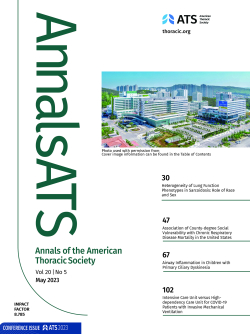 조영준 교수 연구 SCI저널 표지 선정