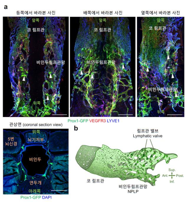 비인두 림프관망의 3차원적 구조