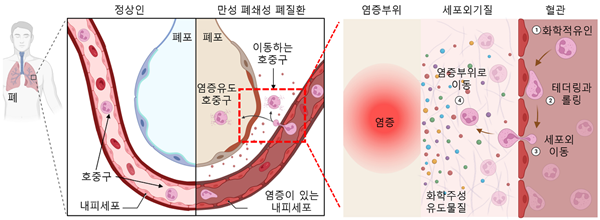 정상인-만성 폐쇄성 폐질환 환자의 호중구 혈관내피세포외 이동 모습