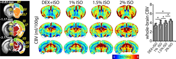 덱스메데토미딘+아이소플루레인(0.3%), 아이소플루레인(1%, 1.5%, 2%) 등 4가지 마취 조건에서 뇌 혈류지표를 측정·계산해 쥐 MRI 뇌 영상에 맵핑한 영상과 수치 결과