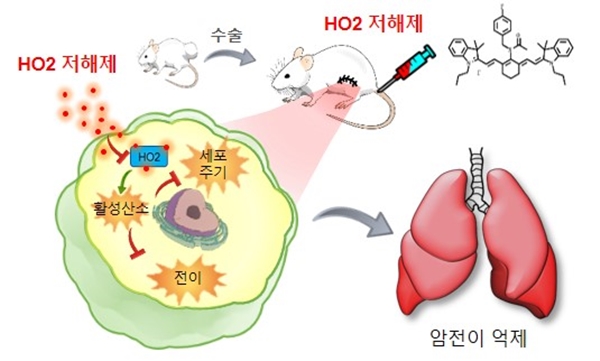 암전이 억제제 타이니어의 기작