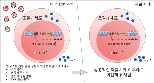 만성 C형 간염 환자의 항바이러스제 약물치료 이후에도 조절 T세포에 염증성 흔적이 남는다는 연구 결과