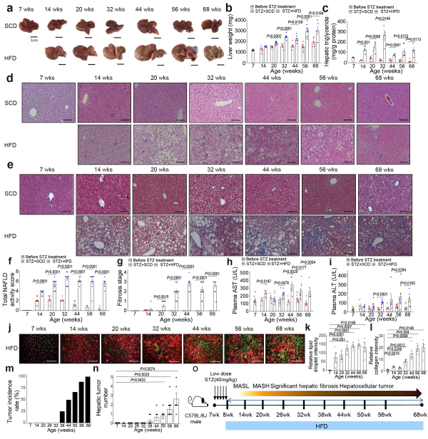 새로운 대사이상 지방간 질환 마우스 모델의 진행 양상