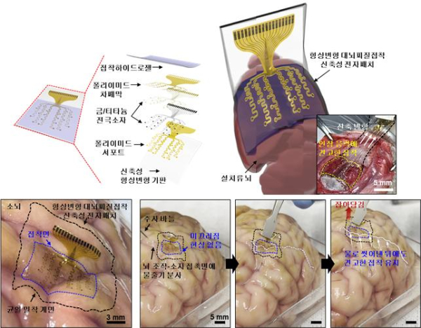 형상변형 대뇌피질접착 신축성 전자패치 개요 및 견고한 뇌 부착력