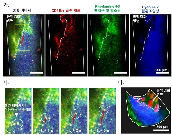 심박 동기화 움직임 보상 기법을 통해 획득한 동맥경화 병변 쥐 경동맥 영상