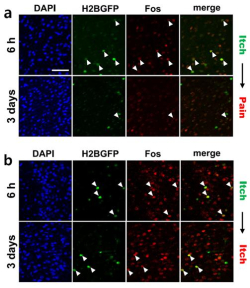 통증과 가려움 유발 자극에 의해 활성화된 뉴런의 시각화