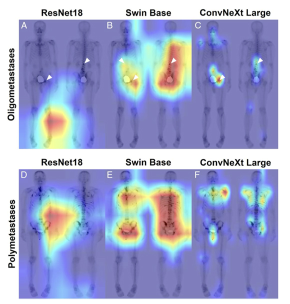 열지도(heatmap) 분석 이미지