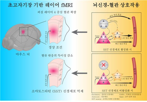 소마토스타틴 신경세포가 매개하는 뇌혈관 반응의 공간 특이성