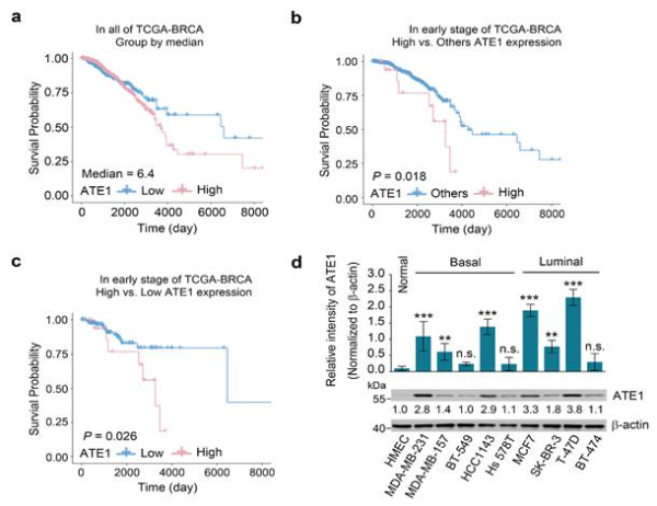 유방암에서의 ATE1 발현 증가와 환자 생존율과의 연관성