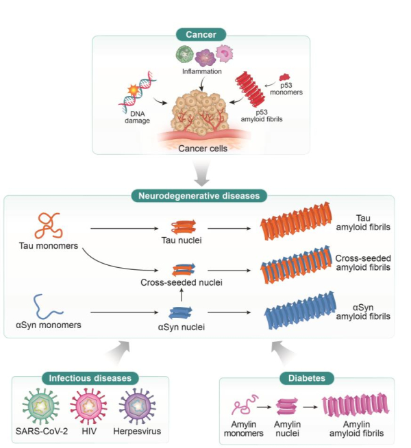 난치성 질환-질환 연계 모델