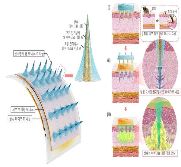 공동 연구팀 웨어러블 마이크로 니들 개발 연구개요도
