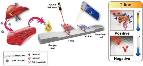 CRP 분석 신속 진단 검사방법 및 고감도 검출 원리
