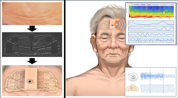 주름 따라 움직이는 EEG 패치 모식도