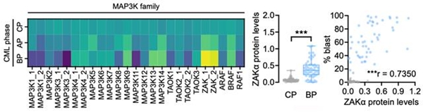 만성골수성백혈병 환자 코호트에서 질환 단계와 ZAK 발현의 임상적 연관성
