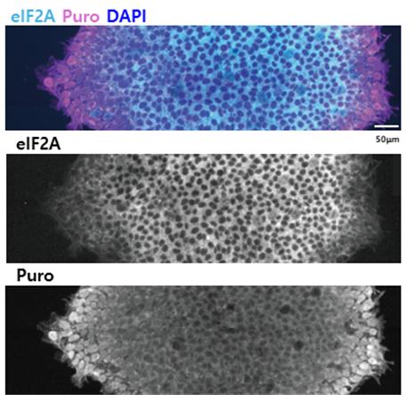 인간 배아줄기세포에서 대체 번역개시인자 eIF2A의 발현 양상