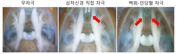 경혈 위치 및 삼차신경절 활성화 / 한의학연 제공