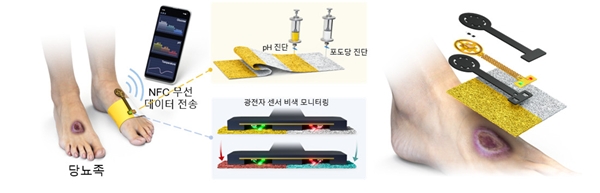 당뇨족 및 당뇨성 질환 진단을 위한 다중모달 비색 드레싱 및 광전자 센서의 개념도