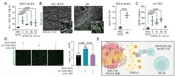 IRE매개의 간암 종양미세환경 변화 및 케모카인 방출