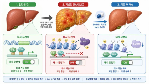 DNMT1 매개 DNA 메틸화에 의한 MASLD 진행 및 Aza-TdC의 치료 기전 모식도